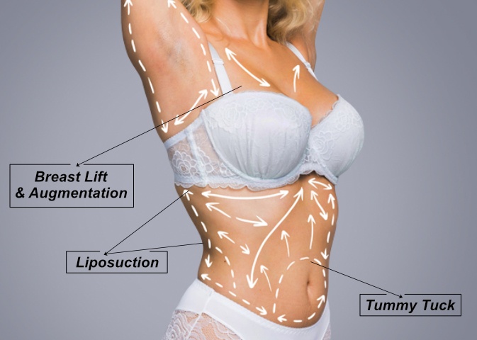 Pressure Garments After Tummy Tuck in Vadodara