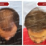 hair-4