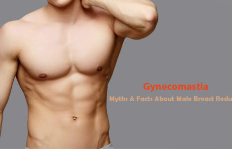 What Is Gynecomastia Surgery Cost In India | Yuva Cosmetic Surgery