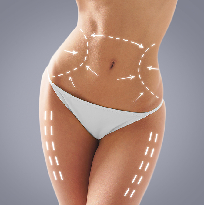 Liposuction-1 Liposuction-1